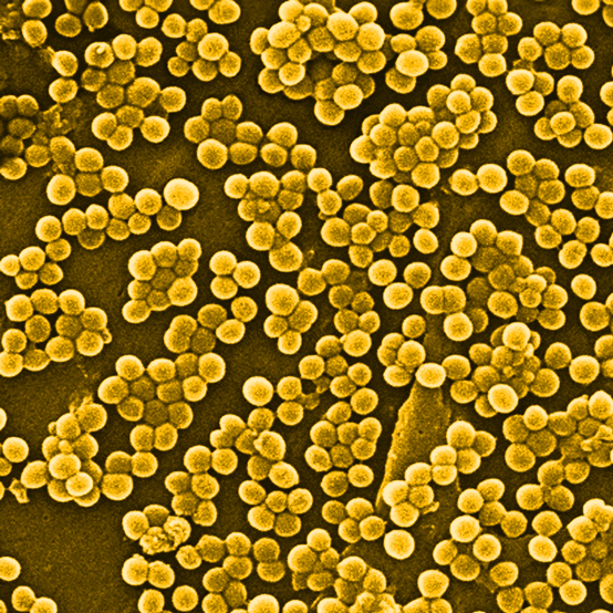 MRSA bacteria under microscope