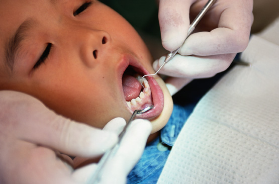 Dentist examining child's mouth
